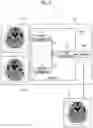 Fig. 15 - Medical image processing apparatus, method, and program