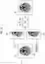 Fig. 17 - Medical image processing apparatus, method, and program