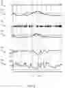 Fig. 03 - A METHOD AND SYSTEM FOR GENERATING A RESPIRATION ALERT
