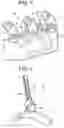 Fig. 04 - Feedwater sparger nozzle repair assembly