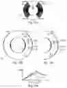 Fig. 15 - Common mode choke