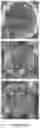 Fig. 05 - Multilayer ceramic electronic component with a multilayer external electrode