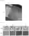 Fig. 05 - Method of fabricating gallium nitride substrate using ion implantation