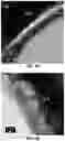 Fig. 09 - Methods and devices for graphene formation on flexible substrates by plasma-enhanced chemical vapor deposition