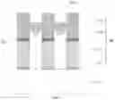 Fig. 09 - Method for manufacturing semiconductor memory having reduced interference between bit lines and word lines