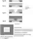Fig. 08 - Fabrication of embedded die packaging comprising laser drilled vias