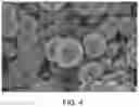 Fig. 05 - Structurally controlled deposition of silicon onto nanowires