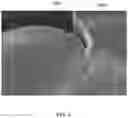 Fig. 07 - Structurally controlled deposition of silicon onto nanowires