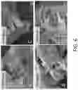 Fig. 10 - HIGH ENTROPY MXENES AND METHODS OF MAKING THEREOF