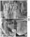 Fig. 11 - HIGH ENTROPY MXENES AND METHODS OF MAKING THEREOF
