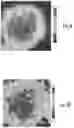 Fig. 08 - Compositions, systems and methods for producing nanoalloys and/or nanocomposites using tandem laser ablation synthesis in solution-galvanic replacement reaction