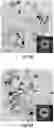 Fig. 16 - Compositions, systems and methods for producing nanoalloys and/or nanocomposites using tandem laser ablation synthesis in solution-galvanic replacement reaction