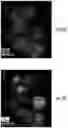 Fig. 38 - Compositions, systems and methods for producing nanoalloys and/or nanocomposites using tandem laser ablation synthesis in solution-galvanic replacement reaction