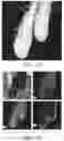 Fig. 09 - Pt—Ni—Ir catalyst for fuel cell