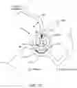 Fig. 17 - Removable terminal pin connector for an active electronics circuit board for use in an implantable medical device