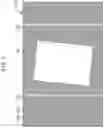 Fig. 08 - IMAGE READING APPARATUS FOR DETECTING END PORTION OF FRONT END OR REAR END OF MEDIUM