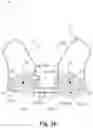 Fig. 05 - Multiple arm dipole antenna for hearing instrument