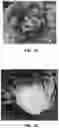 Fig. 02 - Lettuce variety ‘Marciano’