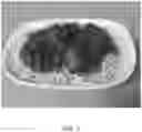 Fig. 04 - Protein compositions for plant-based food products and methods for making