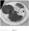 Fig. 15 - Protein compositions for plant-based food products and methods for making
