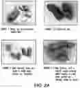 Fig. 03 - METHODS AND COMPOSITIONS FOR TREATING INTESTINAL DYSBIOSIS
