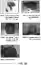 Fig. 04 - METHODS AND COMPOSITIONS FOR TREATING INTESTINAL DYSBIOSIS