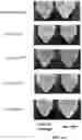 Fig. 07 - Protein compositions and consumable products thereof