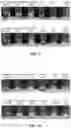 Fig. 10 - Protein compositions and consumable products thereof