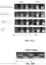 Fig. 13 - Protein compositions and consumable products thereof