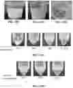 Fig. 16 - Protein compositions and consumable products thereof