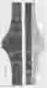 Fig. 03 - Fashionable shapewear