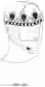 Fig. 14 - ADJUSTABLE FACE SHIELD