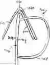 Fig. 01 - MASK SUPPORT SYSTEM AND METHOD