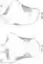 Fig. 14 - BREAST MOTION SIMULATOR