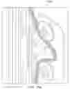 Fig. 27 - BREAST MOTION SIMULATOR