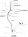 Fig. 04 - SHOE ACCOUTREMENTS AND METHODS OF MAKING AND USING THE SAME