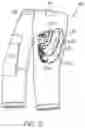 Fig. 03 - Method for assembling a garment portion