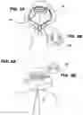 Fig. 04 - Reusable and adjustable heat-insulating bonnet and a cape combination for use in hair treatment