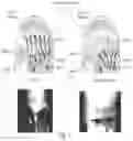Fig. 02 - PREVENTION OF THE WRINKLING AND EXPRESSION OF HUMAN SKIN