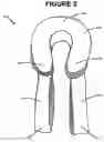 Fig. 03 - Arm support device