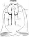 Fig. 04 - Arm support device