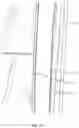 Fig. 21 - Mattress assembly and method
