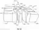 Fig. 44 - Mattress assembly and method