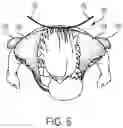 Fig. 07 - Child carrying system with adaptable head support