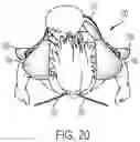 Fig. 21 - Child carrying system with adaptable head support