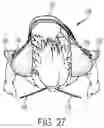 Fig. 28 - Child carrying system with adaptable head support