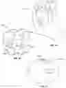 Fig. 11 - Hand cleaning device