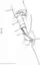 Fig. 11 - TREATMENT TOOL FOR ENDOSCOPE