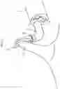 Fig. 12 - TREATMENT TOOL FOR ENDOSCOPE