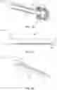 Fig. 03 - Endoscope with integrated attachment mechanisms and methods of use
